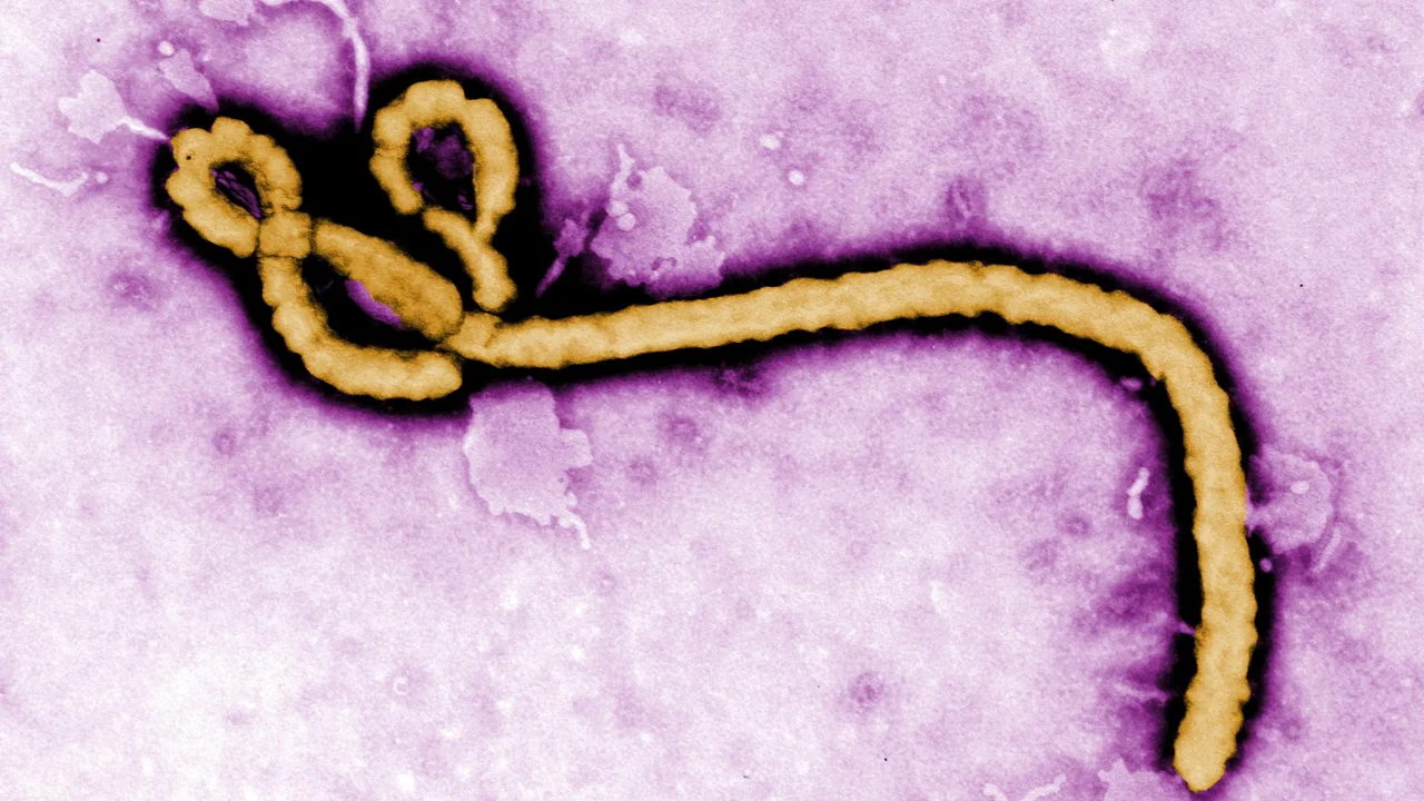 Micrographie électronique colorisée d’un virus Ebola, image scientifique d’archive.